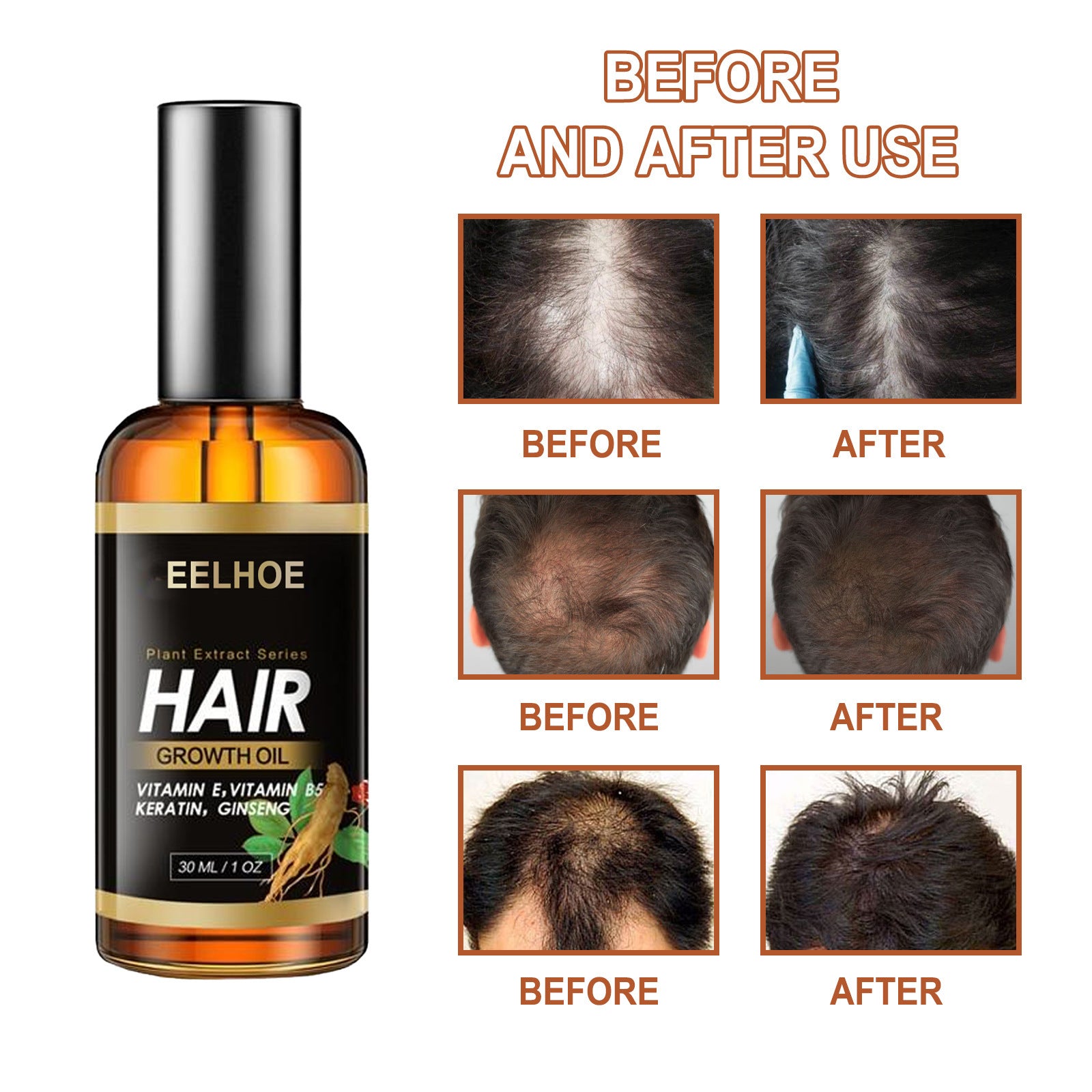 Loss Broken Hair Hair Care Essential Oil
